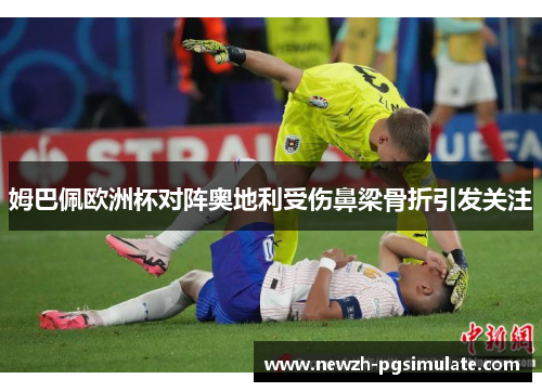 姆巴佩欧洲杯对阵奥地利受伤鼻梁骨折引发关注 姆巴佩欧洲杯对阵奥地利受伤鼻梁骨折引发关注